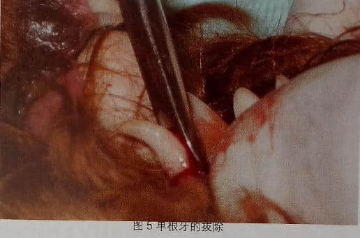 小动物拔牙术