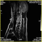 磁共振在小动物临床应用案例报道（一）