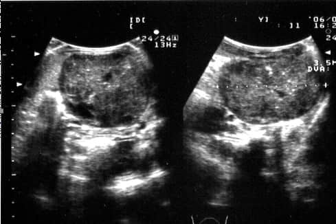 X光、B超在小动物疾病诊断中的联合应用 X光、B超在小动物疾病诊断中的联合应用