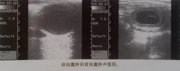 犬猫子宫卵巢常见疾病及其超声诊断 犬猫子宫卵巢常见疾病及其超声诊断