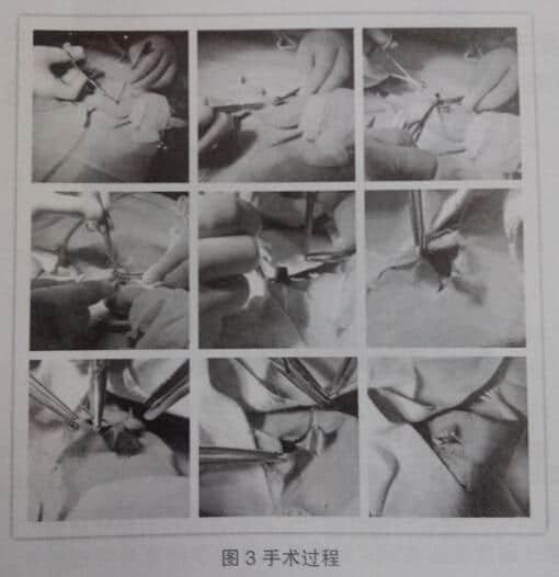 一例鬣蜥胃内异物取出术的报告 一例鬣蜥胃内异物取出术的报告