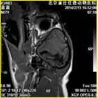 磁共振在小动物临床应用案例报道（一）