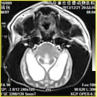 磁共振在小动物临床应用案例报道（一）