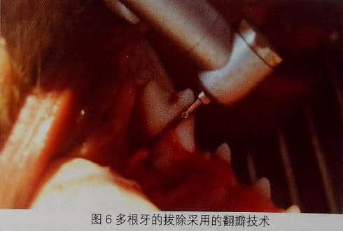 小动物拔牙术