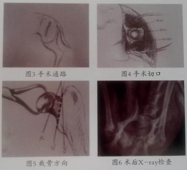 泰迪犬的菜—佩二氏病 手术治疗一例
