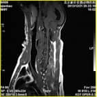 磁共振在小动物临床应用案例报道（一）