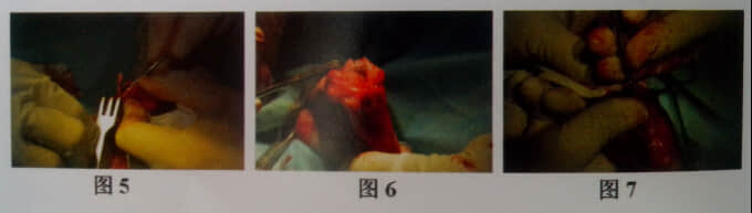 小型犬髌骨内脱位的诊疗 小型犬髌骨内脱位的诊疗