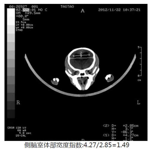 博美犬脑积水的CT诊断 博美犬脑积水的CT诊断