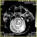 磁共振在小动物临床应用案例报道（一）