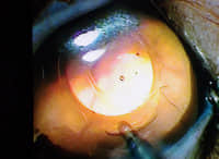 2岁泰迪犬双眼白内障超声乳化手术 2岁泰迪犬双眼白内障超声乳化手术