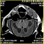 磁共振在小动物临床应用案例报道（一）