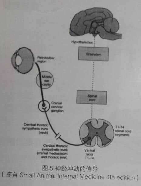 3例霍纳氏综合征(Hnorner's syndrome) 病例讨论