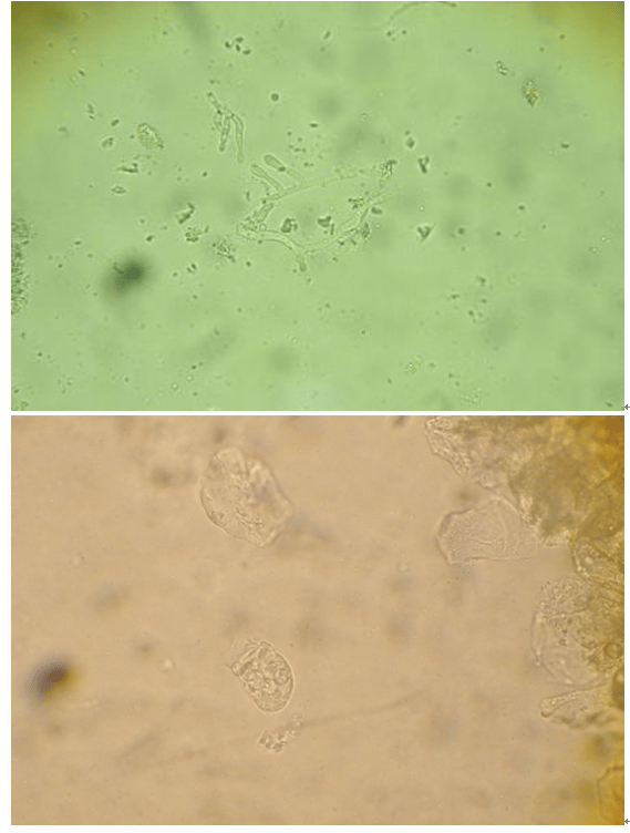 海龟皮肤真菌感染一例