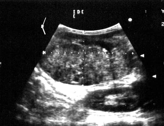 X光、B超在小动物疾病诊断中的联合应用 X光、B超在小动物疾病诊断中的联合应用