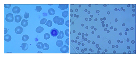 一例犬VC银翘片中毒的病例分析 一例犬VC银翘片中毒的病例分析