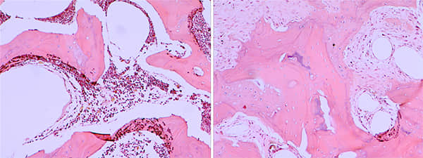 贵妇犬累-卡-佩氏病的诊断与治疗 贵妇犬累-卡-佩氏病的诊断与治疗