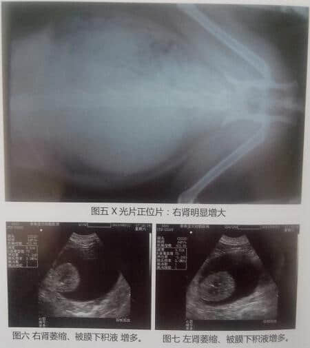 一例15岁家猫双肾周囊肿被膜下积液 一例15岁家猫双肾周囊肿被膜下积液
