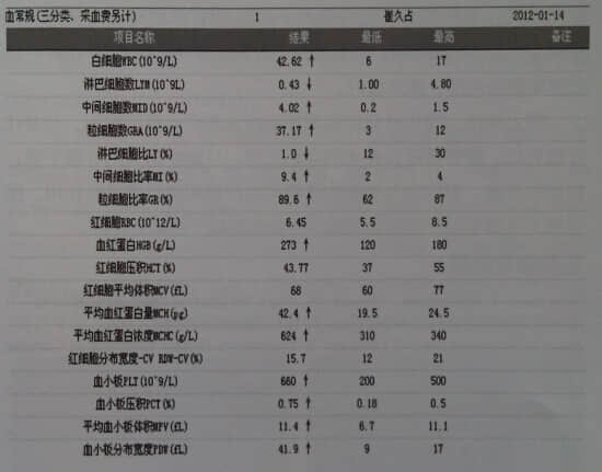 浅谈犬胰腺炎 浅谈犬胰腺炎
