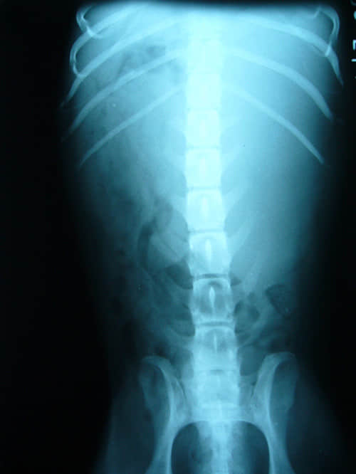 X光、B超在小动物疾病诊断中的联合应用 X光、B超在小动物疾病诊断中的联合应用