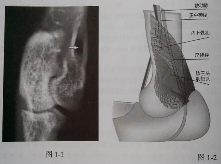 猫常识性骨折特点 猫常识性骨折特点