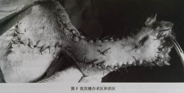 一例皮瓣移植术治疗：犬肢端皮肤缺损