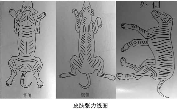 一例皮瓣技术在临床上的应用 一例皮瓣技术在临床上的应用