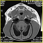 磁共振在小动物临床应用案例报道（一）