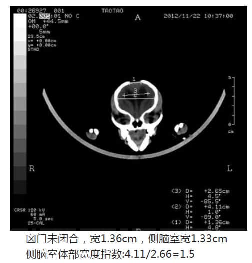 博美犬脑积水的CT诊断 博美犬脑积水的CT诊断