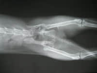 猫咪跳楼--盆骨碎裂 猫咪跳楼--盆骨碎裂