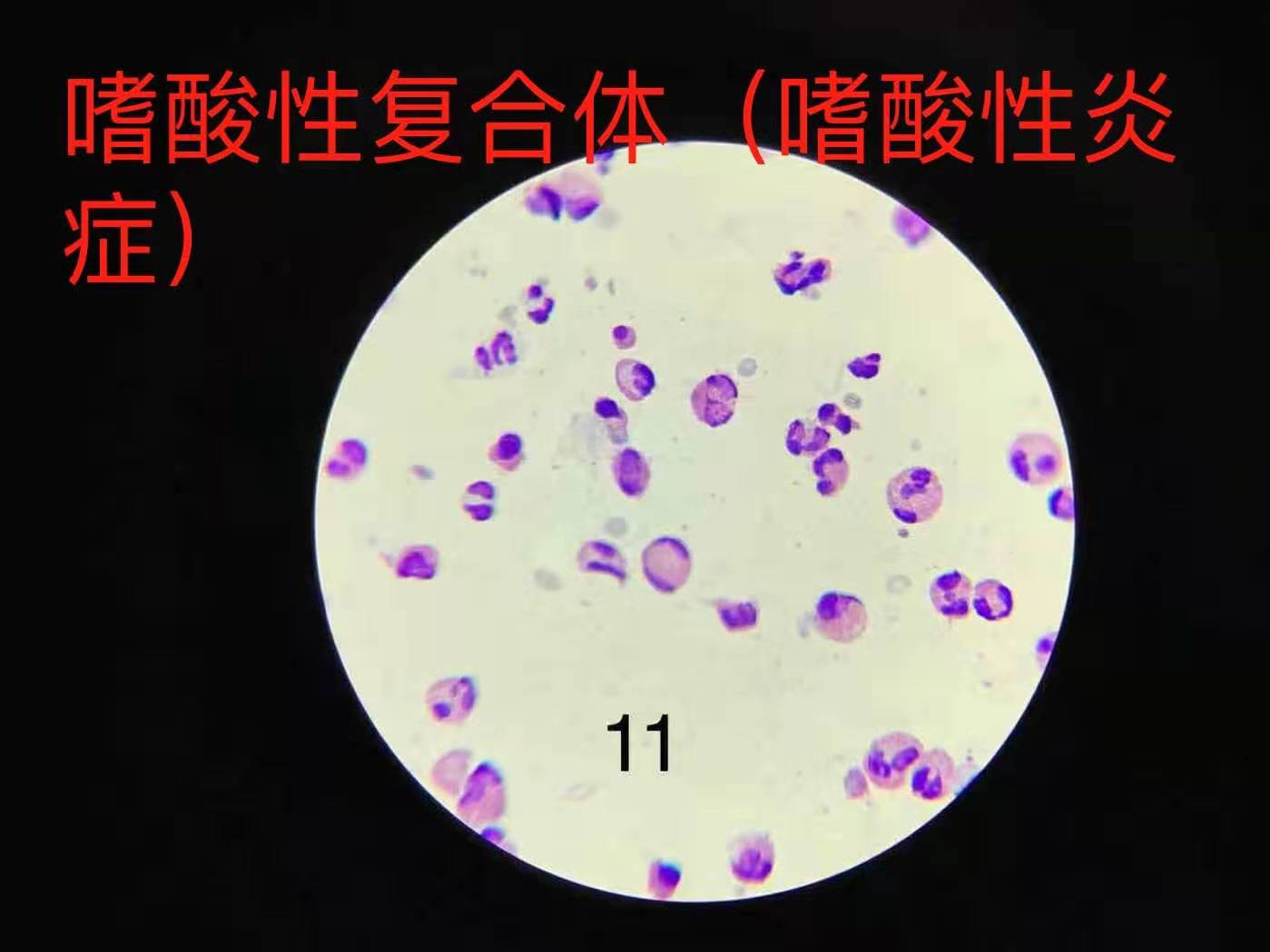 如何快速使用显微镜100倍油镜？