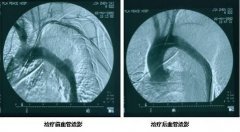 血管造影在宠物临床上的意义